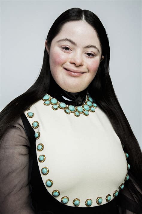 down's syndrome model gucci|down syndrome model.